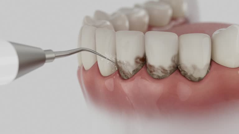 Trusted Tooth Extraction service in St. George, KS - Dentist Open Now